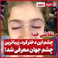 رنگ چشم