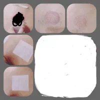 حجامت + بادکش گرم+شکسته بند