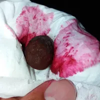 مهره ها وسنگ زینتی|بدلیجات|امیدیه, |دیوار
