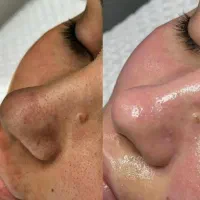بمب تخفیفات فیشال و خدمات پوستی شروع قیمت از ۱۸۸|خدمات آرایشگری و زیبایی|شیراز, فرگاز|دیوار