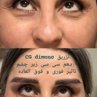 پوست،مو،زیبایی،دکتر تدین زاده|خدمات آرایشگری و زیبایی|کرج, فاز ۳ گوهردشت|دیوار