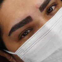 کاشت و میکرو کاشت مو و ابرو