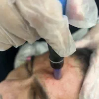 لیزردرمجهزترین،کاملترین کلینیک باحضور اشا محرابی|خدمات آرایشگری و زیبایی|قم, زنبیل آباد|دیوار