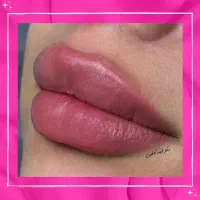 تخفیفات 50% دکتر کاظمی، بوتاکس فیلر مزو ژل لب روسی|خدمات آرایشگری و زیبایی|مشهد, احمدآباد|دیوار