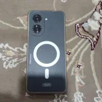 گوشی شیائومی ردمی a5