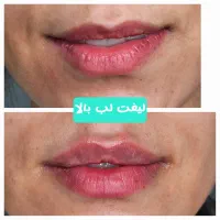 کلینیک زیبایی رز(رویال سابق)|خدمات آرایشگری و زیبایی|دورود, |دیوار