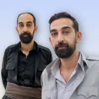 کاشت مو شیرازی