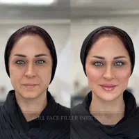 طرح تخفیفی ویژه افتتاحیه شعبه جدید کلینیک|خدمات آرایشگری و زیبایی|کرج, گلشهر|دیوار