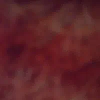 نیاز به پرستار