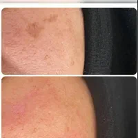 اپیلاسیون دائم،خالبرداری،لیفت ابرو،پارافین تراپی|خدمات آرایشگری و زیبایی|رشت, استقامت ۲|دیوار
