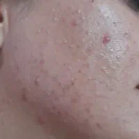 کرم وی آی پی