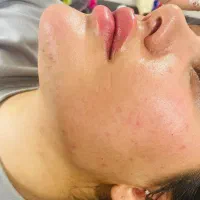 آموزش صفرتا۱۰۰ همه مباحث تزریق فیلر ژل بادی بوتاکس|خدمات آموزشی|شیراز, شریف‌آباد|دیوار