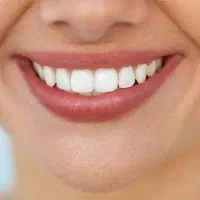 استخدام ادمین اینستاگرام برای کلینیک دندانپزشکی