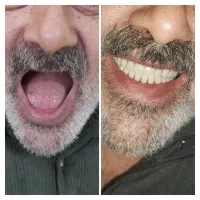 لابراتوار دندانسازی دنت یار