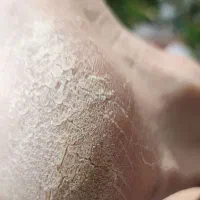 آموزش اسپا و پدیکور درتاچارا توسط مربی فنی حرفه ای