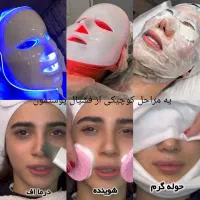 کاشت ناخن،فشیال پوست،لفیت مژه ابرو،موخوره گیری|خدمات آرایشگری و زیبایی|قم, کیوانفر|دیوار