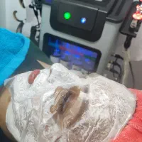 پاکسازی ۳۰۰