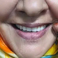 دندانسازی(دندان مصنوعی) لابراتوار