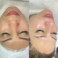 پاکسازی تخصصی صورت،اصلاح صورت وابرو