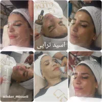 کراتین واحیا مو    فشیال تخصصی  میکرو (ارایش دائم)