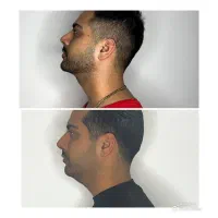 تخلیه غب غب|خدمات آرایشگری و زیبایی|خرم‌آباد, |دیوار