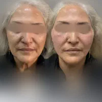 خدمات زیبایی|خدمات آرایشگری و زیبایی|زنجان, |دیوار