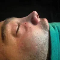 عمل بینی توسط دکتر متخصص جشنواره تخفیف