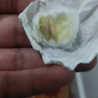 انگشترومهره