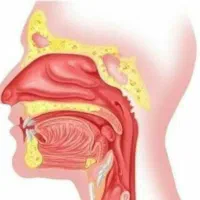 خلط پشت حلق