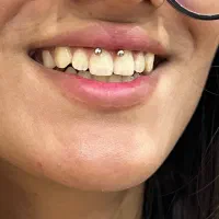 تزریق و آموزش بوتاکس و ژل و پرسینگ و مزو و غیره|خدمات آرایشگری و زیبایی|شیراز, نصر|دیوار