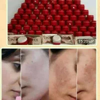 کرم سوپر معجزه