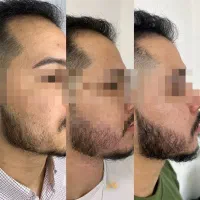 ریشاتو آمازون کن