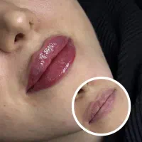 لیدر زیبایی ژل و بوتاکس و کاشت مو|استخدام درمانی، زیبایی، بهداشتی|کرمانشاه, |دیوار