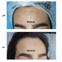 آموزش پی آر پی وپی آر اف|خدمات آموزشی|اصفهان, خانه اصفهان|دیوار