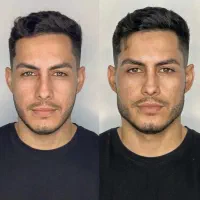 تخفیف خدمات مدلینگ فیلر بوتاکس مزوژل خانم و آقا|خدمات آرایشگری و زیبایی|تهران, پاسداران|دیوار