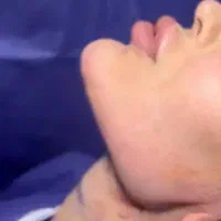 نیازمند همکاری با پزشک جراح جهت بلفارو و مربوطه|استخدام درمانی، زیبایی، بهداشتی|تهران, صادقیه|دیوار