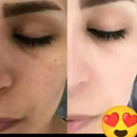 بهترین کرم پوست|آرایشی، بهداشتی، درمانی|کرج, احدآباد|دیوار
