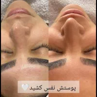 پاکسازی صورت