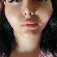 آموزش وخدمات ژلوبوتاکس.پرسینگ.حجامت.زالو.پرستاری|خدمات آرایشگری و زیبایی|پرند, فاز ۲|دیوار