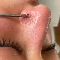 مدل جهت پاکسازی و فیشال و اسکراب اسکالپ پوست و مو|خدمات آرایشگری و زیبایی|مشهد, بهشت|دیوار