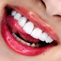 کامپوزیت و لمینیت اقساط