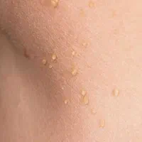 دستگاه خال برداری وزگیل برداری حتی جا های حساس|آرایشی، بهداشتی، درمانی|آبادان, |دیوار