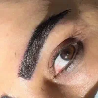 تیم تخصصی کاشت مو و ابرو و ریش میکروکاشت