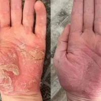آرامش رو به پوست خودت برگردون