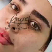 کاشت ابرو