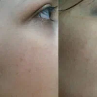 فروش خاویارحلزون درجه یک|آرایشی، بهداشتی، درمانی|رباط‌کریم, رباط‌کریم|دیوار