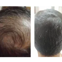 مکمل ارگانیک رویش مجدد وتقویت مژه ابرو مو