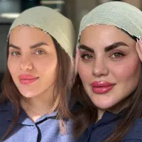 آموزش و خدمات لیفت ابرو ولیفت ولمینت مژه نوبهار