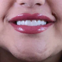 خدمات اقتصادی و استاندارد دندانپزشکی (تاآخرشهریور)