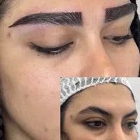 کاشت مو وابرو بدون سیخ سیخ شدن وبهترین خواب